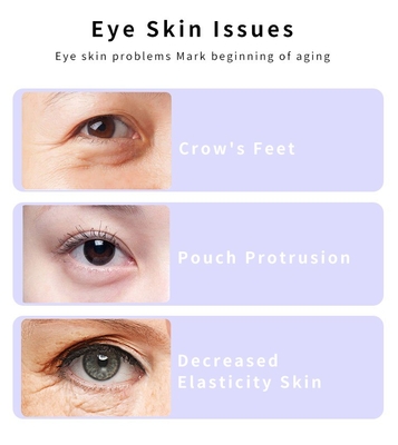 Chăm sóc sức khỏe cá nhân 155*18.3*23.4 mm Rotation Microcurrent Ems Eye Massager Pen